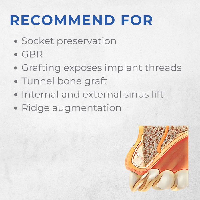 Vitality™ 1.0 CC Mineralized  70/30 Cortical Cancellous Mix 500- 1000 Micron Allograft Bone