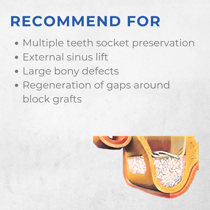 Vitality™ 2.0 CC Mineralized 70/30 Cortical Cancellous Mix 500- 1000 Micron Allograft Bone