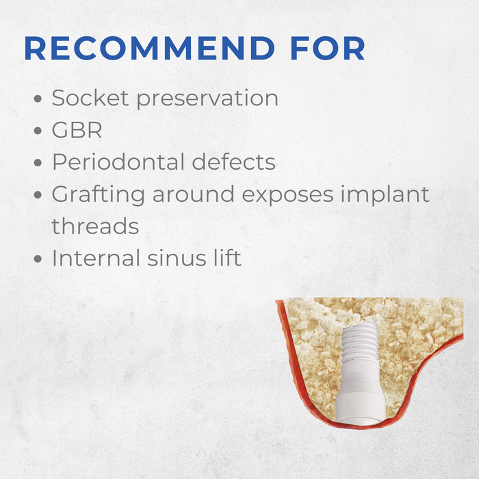 Vitality™ 0.5 CC Mineralized  70/30 Cortical Cancellous Mix 500- 1000 Micron Allograft Bone