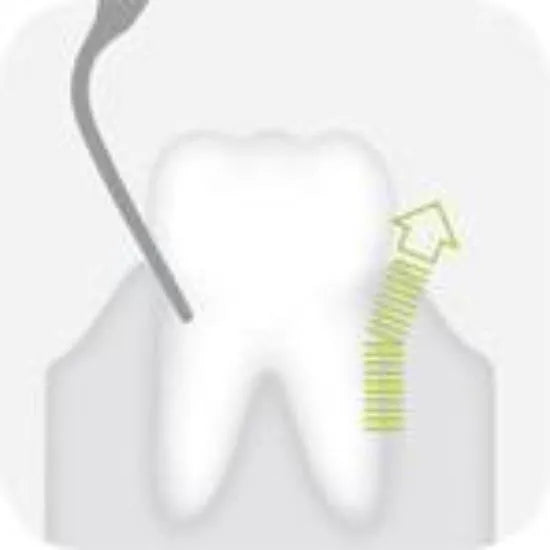 Straight perio tip 1 - Global Dental Shop