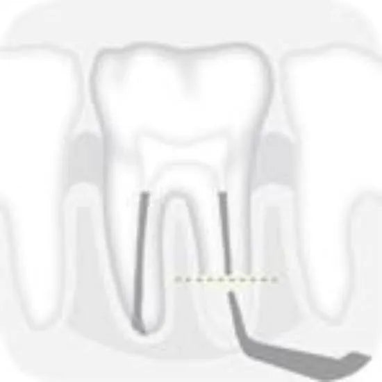 Right Epico tip 2 - Global Dental Shop