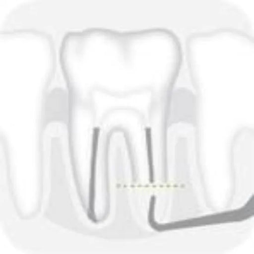 Distal Epico tip 3 - Global Dental Sho