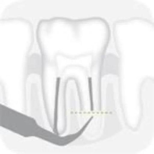 Left Epico tip 4 - Global Dental Shop