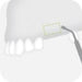 S1 External sinus lift tip 1 - Global Dental Shop